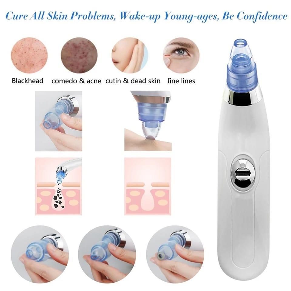 Derma suction roller and black head clear